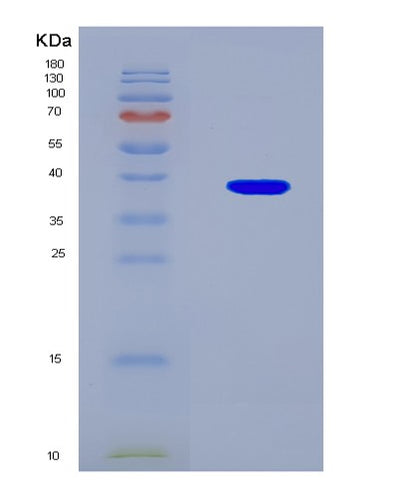 SDS-PAGE analysis of Human FAM76A (Protein Fam76A) - Recombinant Protein, CAT# BLT-08767P showing >90% purity under 15% SDS-PAGE (Reduced)Human FAM76A (Protein Fam76A) - Recombinant Protein