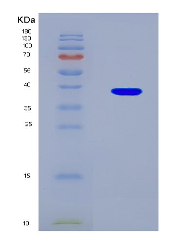 SDS-PAGE analysis of Human FAM76A (Protein Fam76A) - Recombinant Protein, CATHuman FAM76A (Protein Fam76A) - Recombinant Protein