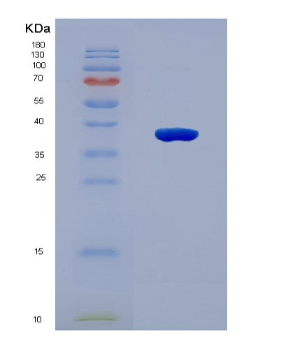 SDS-PAGE analysis of Human ITPR3 (Inositol 1,4,5-Trisphosphate-Gated Calcium Channel Itpr3) - Recombinant Protein, CATHuman ITPR3 (Inositol 1,4,5-Trisphosphate-Gated Calcium Channel Itpr3) - Recombinant Protein