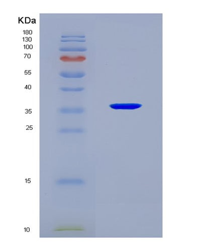 SDS-PAGE analysis of Human SUCLG1 (Succinate--Coa Ligase [Adp/Gdp-Forming] Subunit Alpha, Mitochondrial) - Recombinant Protein, CAT# BLT-08769P showing >90% purity under 15% SDS-PAGE (Reduced)Human SUCLG1 (Succinate--Coa Ligase [Adp/Gdp-Forming] Subunit Alpha, Mitochondrial) - Recombinant Protein