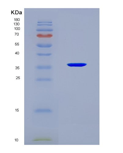 SDS-PAGE analysis of Human SUCLG1 (Succinate--Coa Ligase [Adp/Gdp-Forming] Subunit Alpha, Mitochondrial) - Recombinant Protein, CATHuman SUCLG1 (Succinate--Coa Ligase [Adp/Gdp-Forming] Subunit Alpha, Mitochondrial) - Recombinant Protein