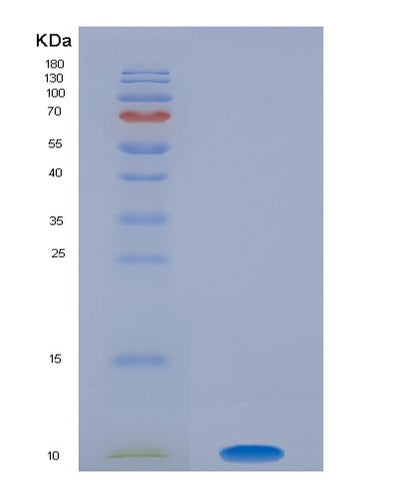 SDS-PAGE analysis of Human S100A1 (Protein S100-A1) - Recombinant Protein, CAT# BLT-08453P showing >90% purity under 15% SDS-PAGE (Reduced)Human S100A1 (Protein S100-A1) - Recombinant Protein