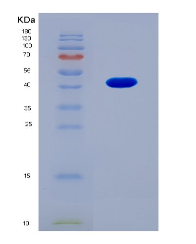 SDS-PAGE analysis of Human EZH2 (Histone-Lysine N-Methyltransferase Ezh2) - Recombinant Protein, CATHuman EZH2 (Histone-Lysine N-Methyltransferase Ezh2) - Recombinant Protein