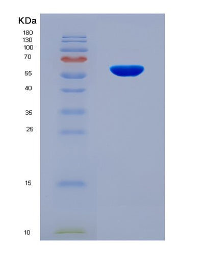 SDS-PAGE analysis of Human HDAC1 (Histone Deacetylase 1) - Recombinant Protein, CAT# BLT-08774P showing >90% purity under 15% SDS-PAGE (Reduced)Human HDAC1 (Histone Deacetylase 1) - Recombinant Protein