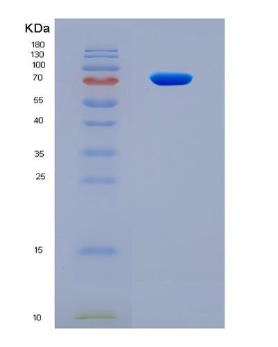 SDS-PAGE analysis of Human HDAC2 (Histone Deacetylase 2) - Recombinant Protein, CAT# BLT-08775P showing >90% purity under 15% SDS-PAGE (Reduced)Human HDAC2 (Histone Deacetylase 2) - Recombinant Protein