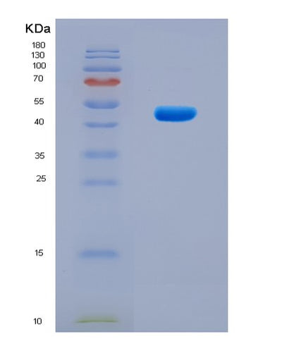 SDS-PAGE analysis of Human HDAC3 (Histone Deacetylase 3) - Recombinant Protein, CAT# BLT-08776P showing >90% purity under 15% SDS-PAGE (Reduced)Human HDAC3 (Histone Deacetylase 3) - Recombinant Protein