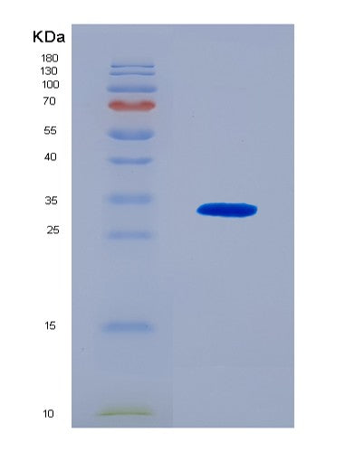SDS-PAGE analysis of Human IL12A (Interleukin-12 Subunit Alpha) - Recombinant Protein, CATHuman IL12A (Interleukin-12 Subunit Alpha) - Recombinant Protein
