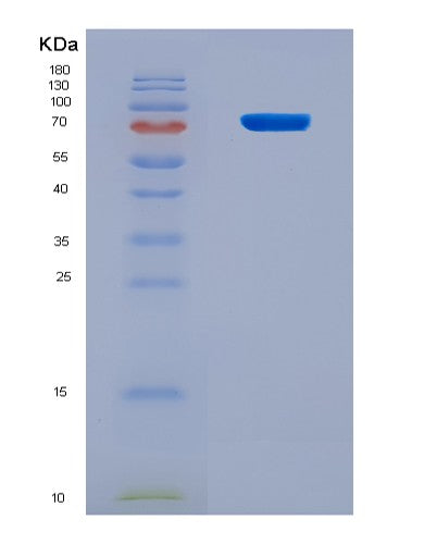 SDS-PAGE analysis of Human P4HA1 (Prolyl 4-Hydroxylase Subunit Alpha-1) - Recombinant Protein, CATHuman P4HA1 (Prolyl 4-Hydroxylase Subunit Alpha-1) - Recombinant Protein