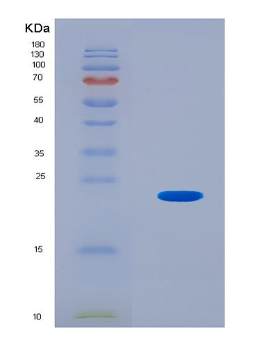 SDS-PAGE analysis of Mouse Ndufa8 (Nadh Dehydrogenase [Ubiquinone] 1 Alpha Subcomplex Subunit 8) - Recombinant Protein, CAT# BLT-08783P showing >90% purity under 15% SDS-PAGE (Reduced)Mouse Ndufa8 (Nadh Dehydrogenase [Ubiquinone] 1 Alpha Subcomplex Subunit 8) - Recombinant Protein