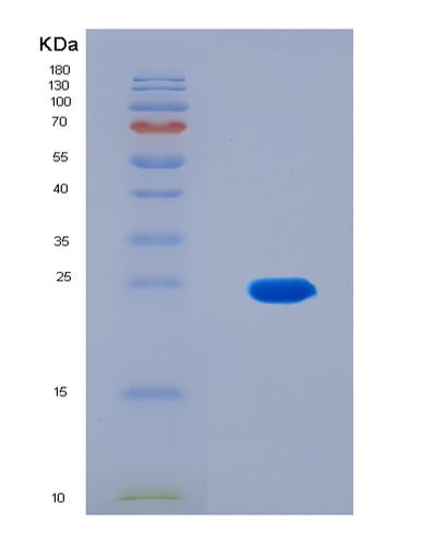 SDS-PAGE analysis of Human NEFM (Neurofilament Medium Polypeptide) - Recombinant Protein, CAT# BLT-08786P showing >90% purity under 15% SDS-PAGE (Reduced)Human NEFM (Neurofilament Medium Polypeptide) - Recombinant Protein