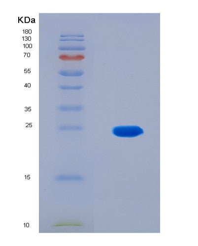SDS-PAGE analysis of Human NEFM (Neurofilament Medium Polypeptide) - Recombinant Protein, CATHuman NEFM (Neurofilament Medium Polypeptide) - Recombinant Protein