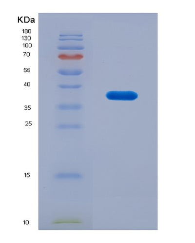 SDS-PAGE analysis of Human CEP55 (Centrosomal Protein Of 55 Kda) - Recombinant Protein, CAT# BLT-08788P showing >90% purity under 15% SDS-PAGE (Reduced)Human CEP55 (Centrosomal Protein Of 55 Kda) - Recombinant Protein