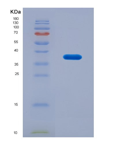 SDS-PAGE analysis of Human CEP55 (Centrosomal Protein Of 55 Kda) - Recombinant Protein, CATHuman CEP55 (Centrosomal Protein Of 55 Kda) - Recombinant Protein