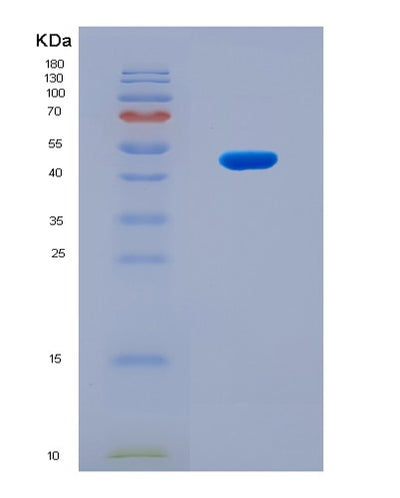 SDS-PAGE analysis of Human WDR77 (Methylosome Protein Wdr77) - Recombinant Protein, CAT# BLT-08793P showing >90% purity under 15% SDS-PAGE (Reduced)Human WDR77 (Methylosome Protein Wdr77) - Recombinant Protein