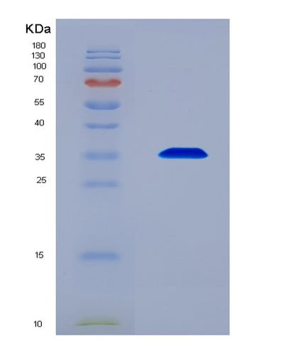 SDS-PAGE analysis of Human THPO (Thrombopoietin) - Recombinant Protein, CAT# BLT-08796P showing >90% purity under 15% SDS-PAGE (Reduced)Human THPO (Thrombopoietin) - Recombinant Protein