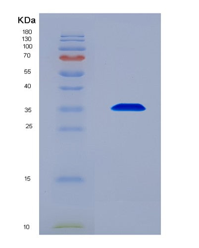 SDS-PAGE analysis of Human THPO (Thrombopoietin) - Recombinant Protein, CATHuman THPO (Thrombopoietin) - Recombinant Protein
