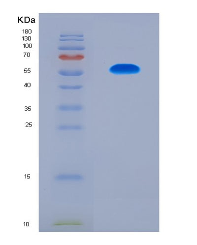 SDS-PAGE analysis of Human ADAMTS13 (A Disintegrin And Metalloproteinase With Thrombospondin Motifs 13) - Recombinant Protein, CAT# BLT-08797P showing >90% purity under 15% SDS-PAGE (Reduced)Human ADAMTS13 (A Disintegrin And Metalloproteinase With Thrombospondin Motifs 13) - Recombinant Protein