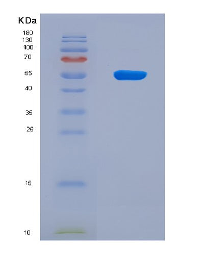 SDS-PAGE analysis of Human NADK (Nad Kinase) - Recombinant Protein, CAT# BLT-08798P showing >90% purity under 15% SDS-PAGE (Reduced)Human NADK (Nad Kinase) - Recombinant Protein