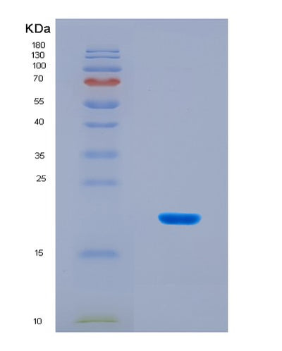 SDS-PAGE analysis of Human ADISSP (Adipose-Secreted Signaling Protein) - Recombinant Protein, CAT# BLT-08800P showing >90% purity under 15% SDS-PAGE (Reduced)Human ADISSP (Adipose-Secreted Signaling Protein) - Recombinant Protein