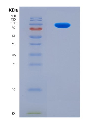 SDS-PAGE analysis of Human COP1 (E3 Ubiquitin-Protein Ligase Cop1) - Recombinant Protein, CATHuman COP1 (E3 Ubiquitin-Protein Ligase Cop1) - Recombinant Protein