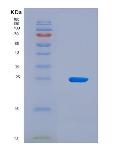 SDS-PAGE analysis of Human LTB (Lymphotoxin-Beta) - Recombinant Protein, CAT# BLT-08803P showing >90% purity under 15% SDS-PAGE (Reduced)Human LTB (Lymphotoxin-Beta) - Recombinant Protein