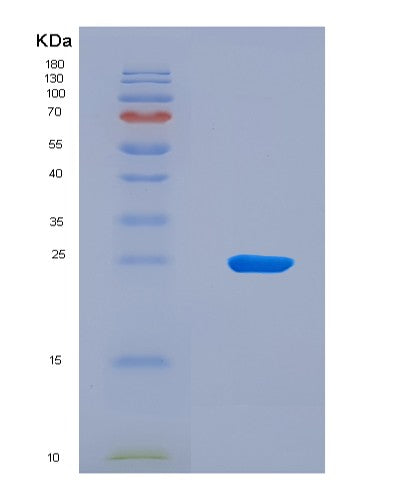 SDS-PAGE analysis of Human LTB (Lymphotoxin-Beta) - Recombinant Protein, CATHuman LTB (Lymphotoxin-Beta) - Recombinant Protein