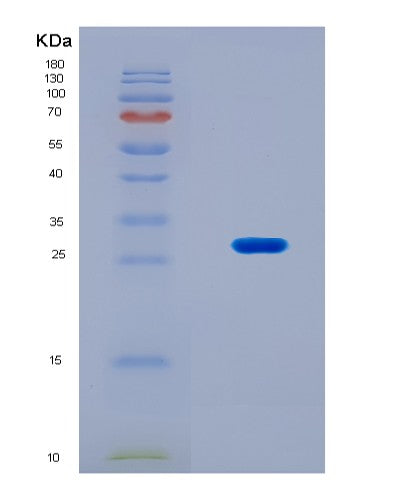 SDS-PAGE analysis of Human MBD1 (Methyl-Cpg-Binding Domain Protein 1) - Recombinant Protein, CATHuman MBD1 (Methyl-Cpg-Binding Domain Protein 1) - Recombinant Protein