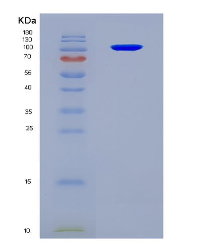 SDS-PAGE analysis of Human SEMA3A (Semaphorin-3A) - Recombinant Protein, CAT# BLT-08808P showing >90% purity under 15% SDS-PAGE (Reduced)Human SEMA3A (Semaphorin-3A) - Recombinant Protein