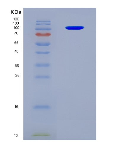 SDS-PAGE analysis of Human SEMA3A (Semaphorin-3A) - Recombinant Protein, CATHuman SEMA3A (Semaphorin-3A) - Recombinant Protein