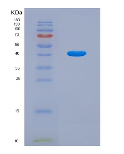 SDS-PAGE analysis of Human HNRNPA2B1 (Heterogeneous Nuclear Ribonucleoproteins A2/B1) - Recombinant Protein, CAT# BLT-08809P showing >90% purity under 15% SDS-PAGE (Reduced)Human HNRNPA2B1 (Heterogeneous Nuclear Ribonucleoproteins A2/B1) - Recombinant Protein