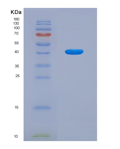SDS-PAGE analysis of Human HNRNPA2B1 (Heterogeneous Nuclear Ribonucleoproteins A2/B1) - Recombinant Protein, CATHuman HNRNPA2B1 (Heterogeneous Nuclear Ribonucleoproteins A2/B1) - Recombinant Protein