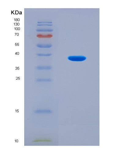 SDS-PAGE analysis of Human CTSL (Procathepsin L) - Recombinant Protein, CATHuman CTSL (Procathepsin L) - Recombinant Protein