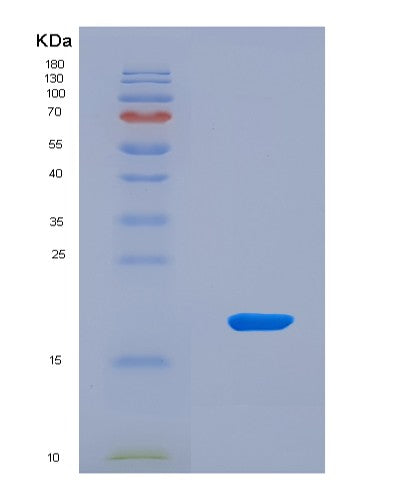 SDS-PAGE analysis of Human IL21 (Interleukin-21) - Recombinant Protein, CATHuman IL21 (Interleukin-21) - Recombinant Protein