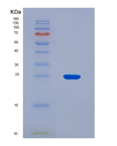 SDS-PAGE analysis of Human IL32 (Interleukin-32) - Recombinant Protein, CAT# BLT-08813P showing >90% purity under 15% SDS-PAGE (Reduced)Human IL32 (Interleukin-32) - Recombinant Protein