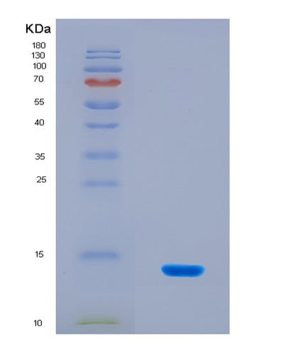 SDS-PAGE analysis of Human ANO6 (Anoctamin-6) - Recombinant Protein, CAT# BLT-08814P showing >90% purity under 15% SDS-PAGE (Reduced)Human ANO6 (Anoctamin-6) - Recombinant Protein