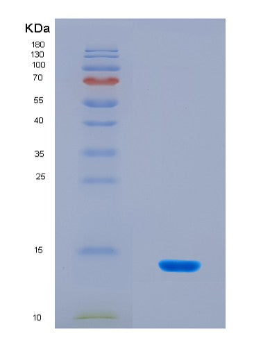 SDS-PAGE analysis of Human ANO6 (Anoctamin-6) - Recombinant Protein, CATHuman ANO6 (Anoctamin-6) - Recombinant Protein
