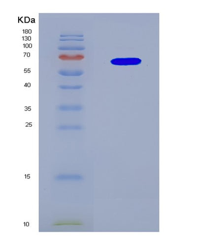 SDS-PAGE analysis of Human TTBK1 (Tau-Tubulin Kinase 1) - Recombinant Protein, CAT# BLT-08817P showing >90% purity under 15% SDS-PAGE (Reduced)Human TTBK1 (Tau-Tubulin Kinase 1) - Recombinant Protein