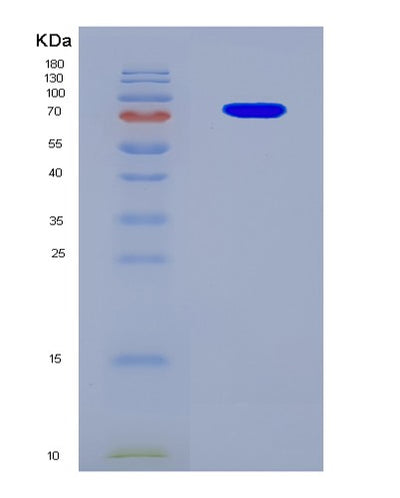 SDS-PAGE analysis of Human GBP5 (Guanylate-Binding Protein 5) - Recombinant Protein, CAT# BLT-08818P showing >90% purity under 15% SDS-PAGE (Reduced)Human GBP5 (Guanylate-Binding Protein 5) - Recombinant Protein