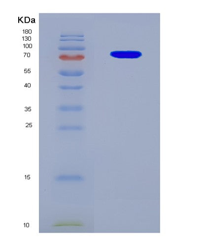 SDS-PAGE analysis of Human GBP5 (Guanylate-Binding Protein 5) - Recombinant Protein, CATHuman GBP5 (Guanylate-Binding Protein 5) - Recombinant Protein