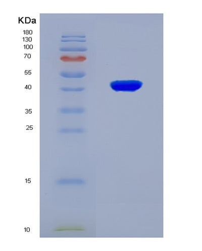 SDS-PAGE analysis of Mouse Sdhc (Succinate Dehydrogenase Cytochrome B560 Subunit, Mitochondrial) - Recombinant Protein, CAT# BLT-08819P showing >90% purity under 15% SDS-PAGE (Reduced)Mouse Sdhc (Succinate Dehydrogenase Cytochrome B560 Subunit, Mitochondrial) - Recombinant Protein