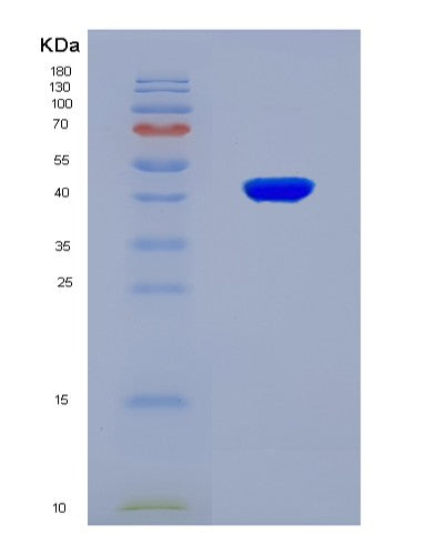 SDS-PAGE analysis of Mouse Sdhc (Succinate Dehydrogenase Cytochrome B560 Subunit, Mitochondrial) - Recombinant Protein, CATMouse Sdhc (Succinate Dehydrogenase Cytochrome B560 Subunit, Mitochondrial) - Recombinant Protein
