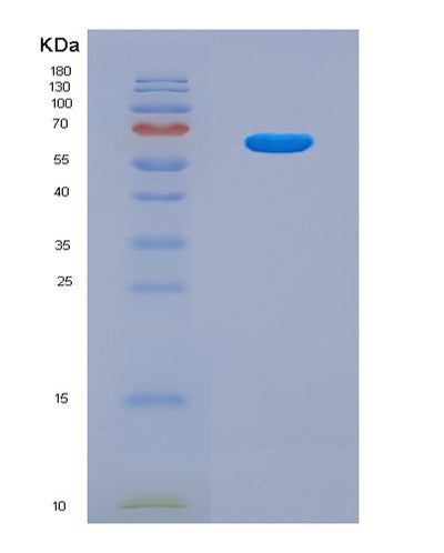 SDS-PAGE analysis of Human STAT3 (Signal Transducer And Activator Of Transcription 3) - Recombinant Protein, CAT# BLT-08820P showing >95% purity under 15% SDS-PAGE (Reduced)Human STAT3 (Signal Transducer And Activator Of Transcription 3) - Recombinant Protein