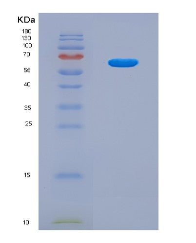 SDS-PAGE analysis of Human STAT3 (Signal Transducer And Activator Of Transcription 3) - Recombinant Protein, CATHuman STAT3 (Signal Transducer And Activator Of Transcription 3) - Recombinant Protein