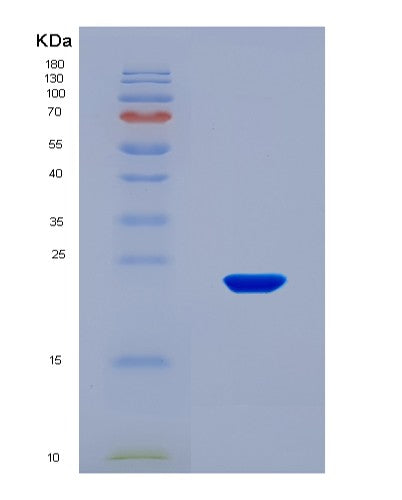 SDS-PAGE analysis of Human SUGP2 (Surp And G-Patch Domain-Containing Protein 2) - Recombinant Protein, CATHuman SUGP2 (Surp And G-Patch Domain-Containing Protein 2) - Recombinant Protein