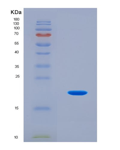 SDS-PAGE analysis of Mouse Sugp2 (Surp And G-Patch Domain-Containing Protein 2) - Recombinant Protein, CAT# BLT-08822P showing >95% purity under 15% SDS-PAGE (Reduced)Mouse Sugp2 (Surp And G-Patch Domain-Containing Protein 2) - Recombinant Protein