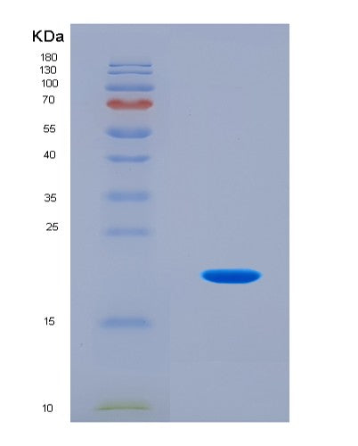 SDS-PAGE analysis of Mouse Sugp2 (Surp And G-Patch Domain-Containing Protein 2) - Recombinant Protein, CATMouse Sugp2 (Surp And G-Patch Domain-Containing Protein 2) - Recombinant Protein