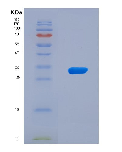 SDS-PAGE analysis of Human MTAP (S-Methyl-5&Human MTAP (S-Methyl-5'-Thioadenosine Phosphorylase) - Recombinant Protein