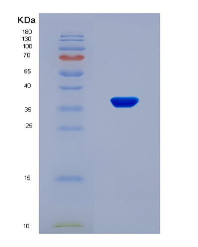 SDS-PAGE analysis of Human DUSP6 (Dual Specificity Protein Phosphatase 6) - Recombinant Protein, CAT# BLT-08825P showing >90% purity under 15% SDS-PAGE (Reduced)Human DUSP6 (Dual Specificity Protein Phosphatase 6) - Recombinant Protein