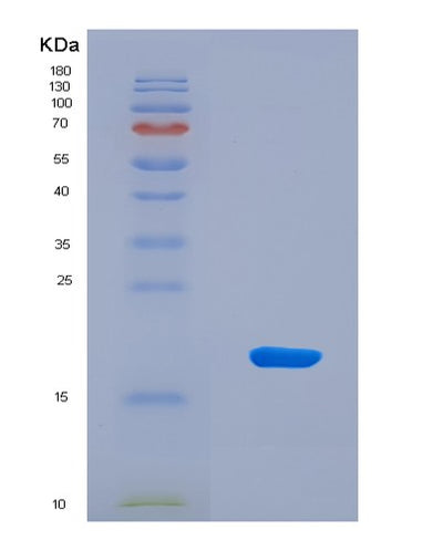 SDS-PAGE analysis of Mouse Npm1 (Nucleophosmin) - Recombinant Protein, CAT# BLT-08828P showing >90% purity under 15% SDS-PAGE (Reduced)Mouse Npm1 (Nucleophosmin) - Recombinant Protein