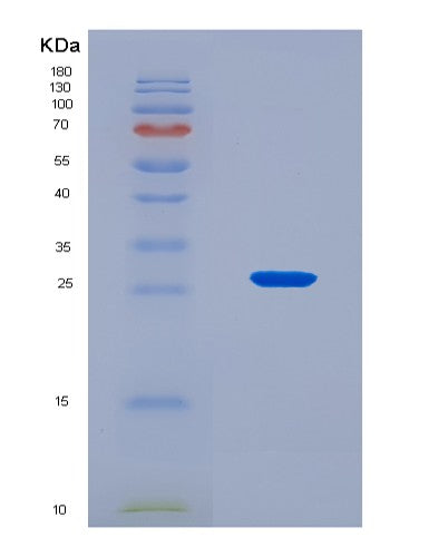SDS-PAGE analysis of Human TIMP3 (Metalloproteinase Inhibitor 3) - Recombinant Protein, CATHuman TIMP3 (Metalloproteinase Inhibitor 3) - Recombinant Protein